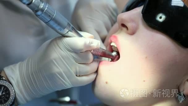 00:301080pnew放大镜检查口腔的年轻女牙医- 00:104knew女性口腔医生