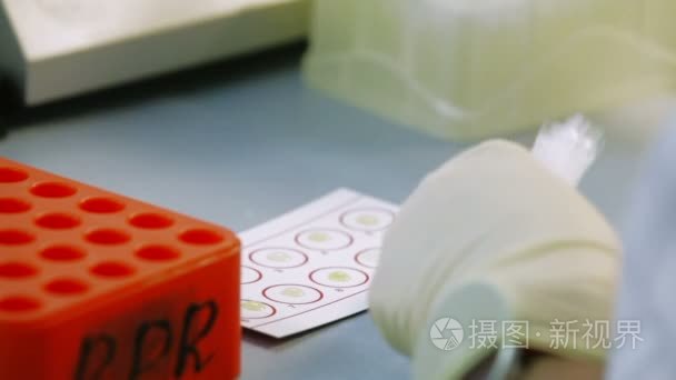 橡胶手套在实验室的医生采取血液样本，测试他们的感染。关闭