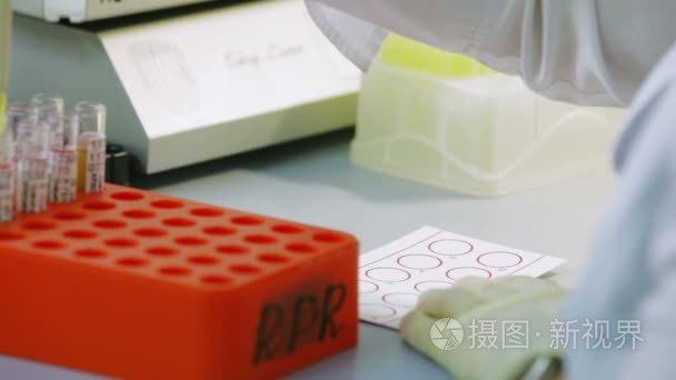 在实验室里戴上橡胶手套，医生需要血液样本，测试他们的感染。特写