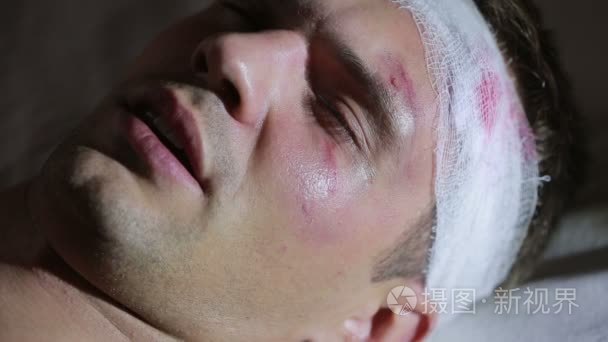 头部受伤躺在床上的男人.头部缠着绷带.他的脸上青肿短视频