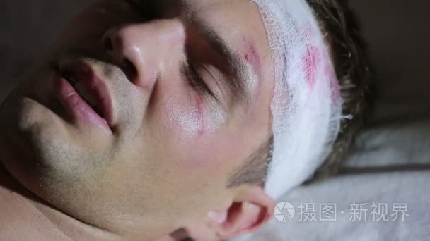 头部受伤躺在床上的男人头部缠着绷带他的脸上青肿