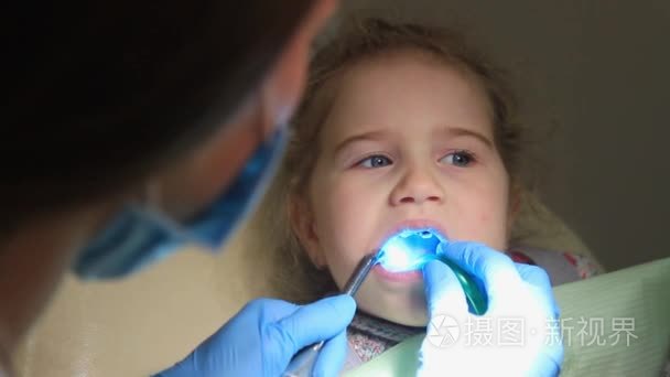 牙医把孩子光致聚合物视频