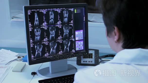 女医生在医院探险家的 x 射线图像上监视器特写