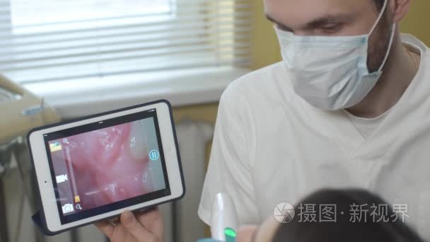 牙医用口相机示范视频