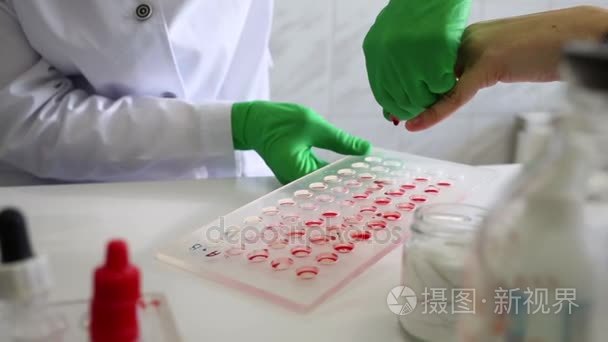 医学实验室工作人员需要血液部分