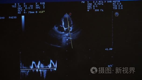 超音波检查视频素材 超音波检查实拍视频下载 第1页 摄图新视界视频库