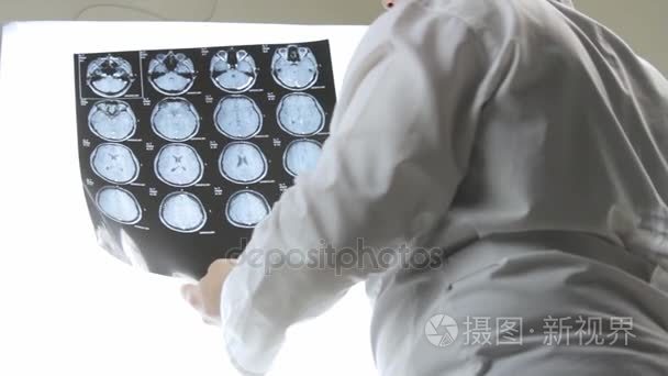 医生他手里拿着大脑，诊断 Mri 扫描