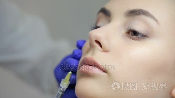 肉毒杆菌注射在嘴唇的医生视频