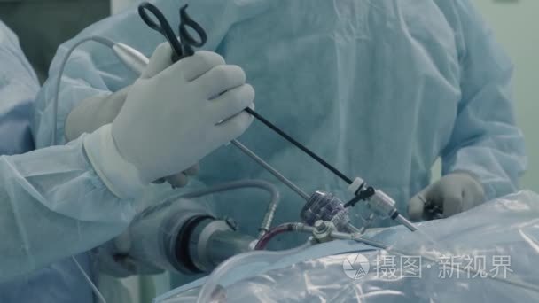 腹腔镜手术的腹部视频