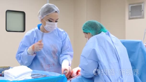 执行手术的手术团队视频