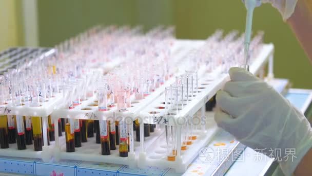 医学实验室技术员使血液测试视频