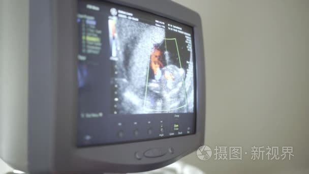 屏幕显示扫描仪一个怀孕的女人视频