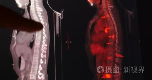 4 k 医生触摸宠物 Ct x 线片上触摸屏 ipad 应用程序软件的分析