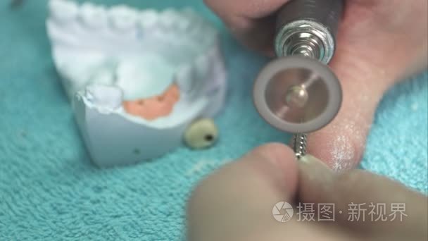 实验室技术员制造牙科术视频