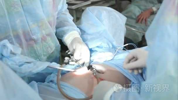 手术室手术组做腹腔镜手术视频
