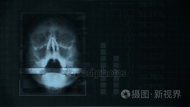 扫描人颅骨  环形灰色平视显示器接口医疗设备