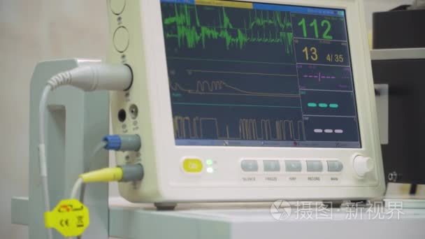 手术室心脏监护仪视频