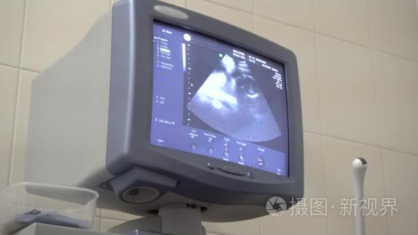 4k 妊娠妇女的影像声像图分析
