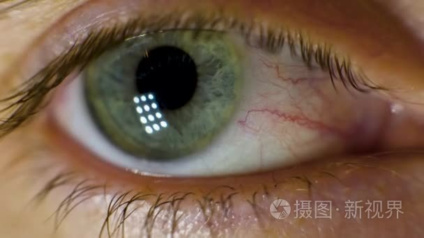 瞳孔对光反射视频素材