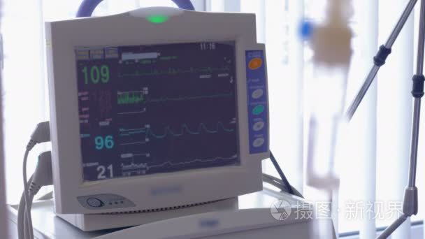 屏幕显示患者病情监测结果: 脉搏、血压、体温