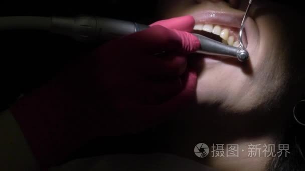 牙医为病人做牙齿清洗视频