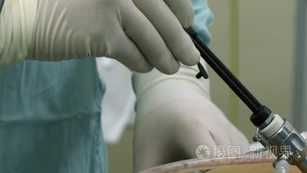 腹腔镜在手术室特写中的作用视频
