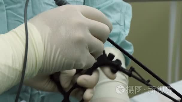 腹腔镜在手术室特写中的作用视频