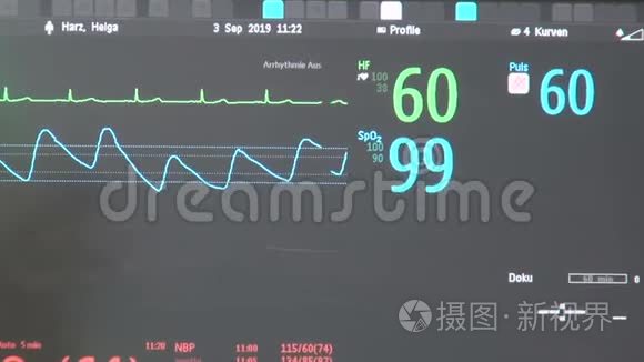心电图心脏监视器视频