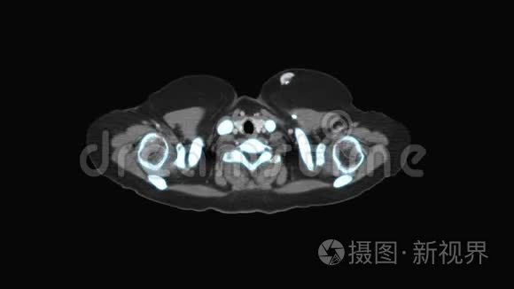 医学MRI扫描监视器，CT或CAT扫描仪图像