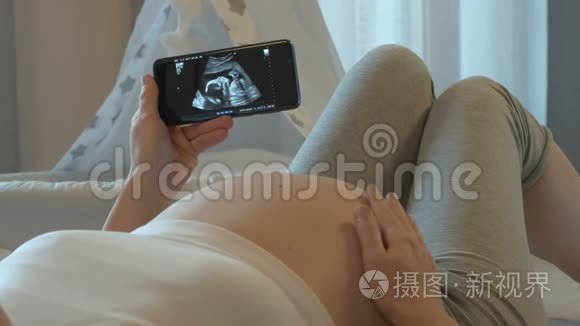 智能手机屏幕上胎儿超声检查视频