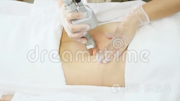 专业美容师做激光脱毛视频