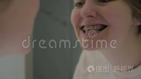 戴牙套的女孩照镜子视频