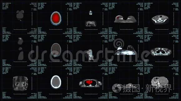 磁共振成像扫描监视器视频