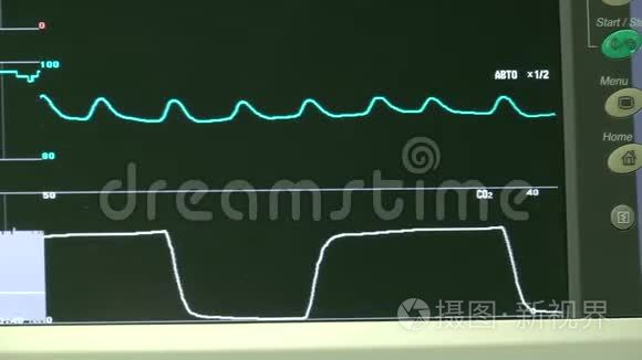 手术室心脏监视器的工作视频