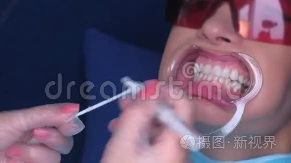 牙科用凝胶剂对女性患者`牙齿进行LED美白。