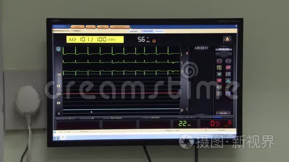 医院心率监测仪附图视频