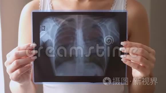 肺部X线摄影的概念。 病毒和细菌感染了人类的肺。 肺癌或肺炎患者。