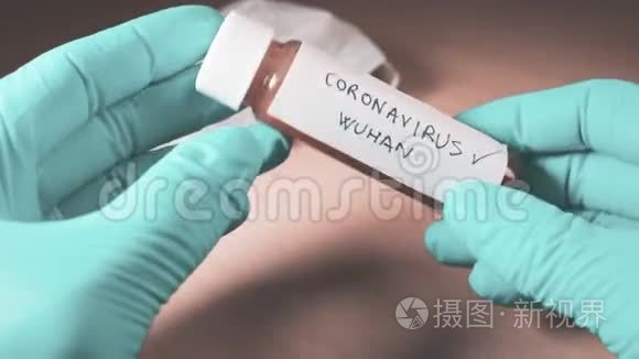 医生用冠状病毒标记血样管阳性视频