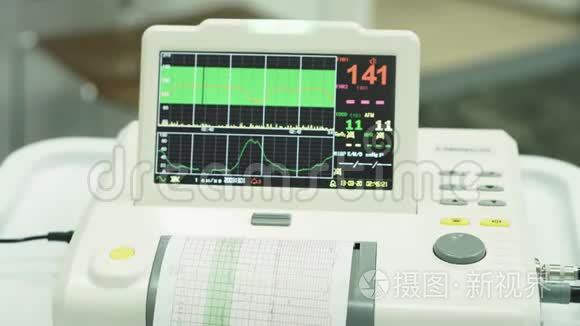心电图监测心电图。 胎儿在子宫内心跳测量过程中`心电图显示。 计量