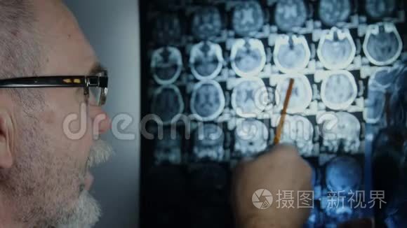 高级医生复查脑部核磁共振视频