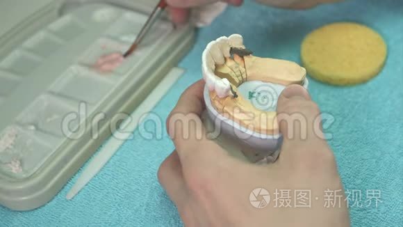 牙科技师做牙齿种植视频