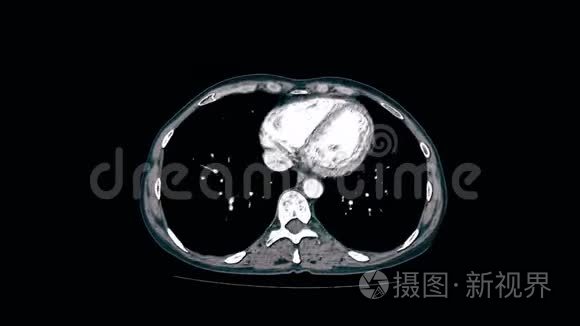 腹腔胃肠道膀胱的彩色对比MRI