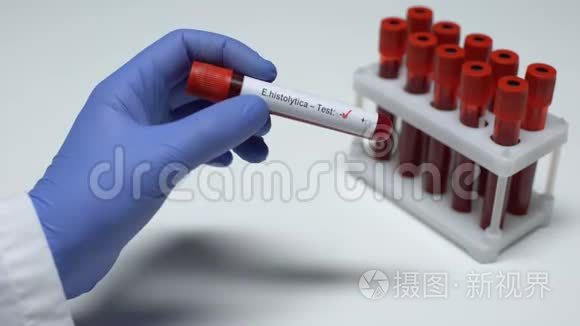 化验结果为阴性，医生在试管中显示血样
