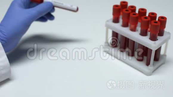 双酚C检测阳性，医生在试管中显示血样，实验室研究
