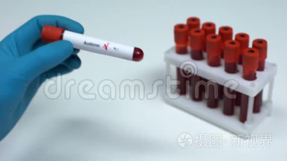 丙酮检测阴性，医生抽血，实验室研究健康检查