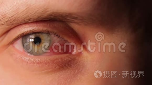 new病态的红人眼- 00:401080p闭着眼睛的病态女人肖像- 00:134knew