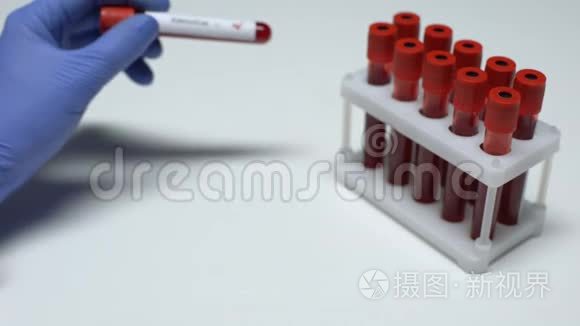 腺病毒检测阳性，医生在试管中显示血样，实验室研究
