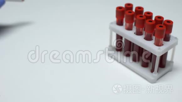 MERS-CoV试验阳性，医生在试管中显示血样，健康检查