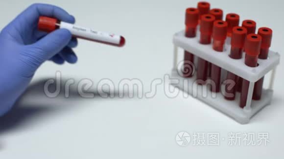 淀粉酶检测阳性，医生提供血样，实验室研究，健康检查