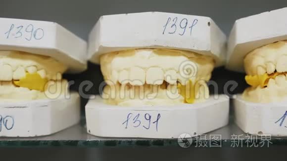 铸造人牙颌的牙科石膏模型视频